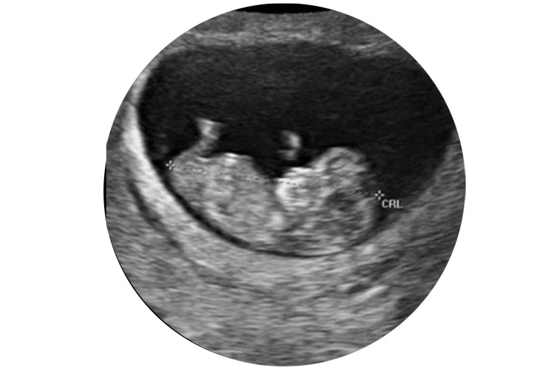 مراحل بارداری هفته به هفته (9 الی 12)