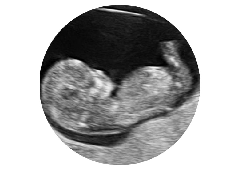 مراحل بارداری هفته به هفته (9 الی 12)