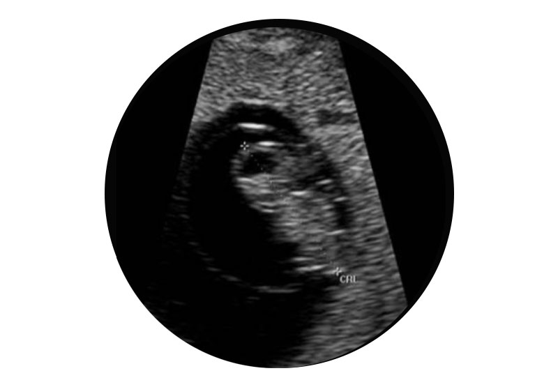 جنین ماه هفت
